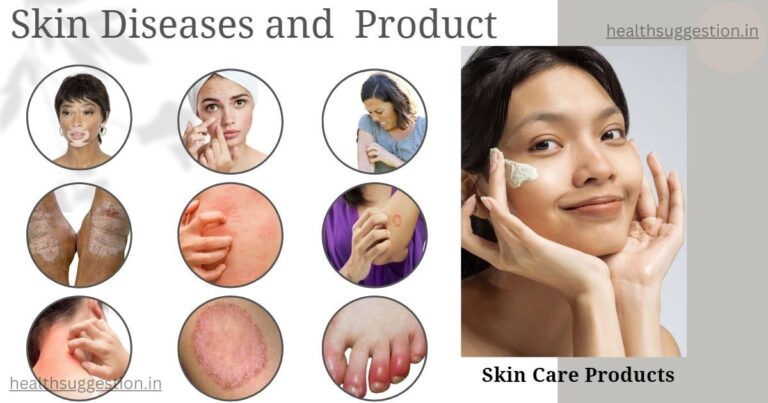 चर्म रोग कितने प्रकार के होते - 5 skin allergy types with pictures in Hindi