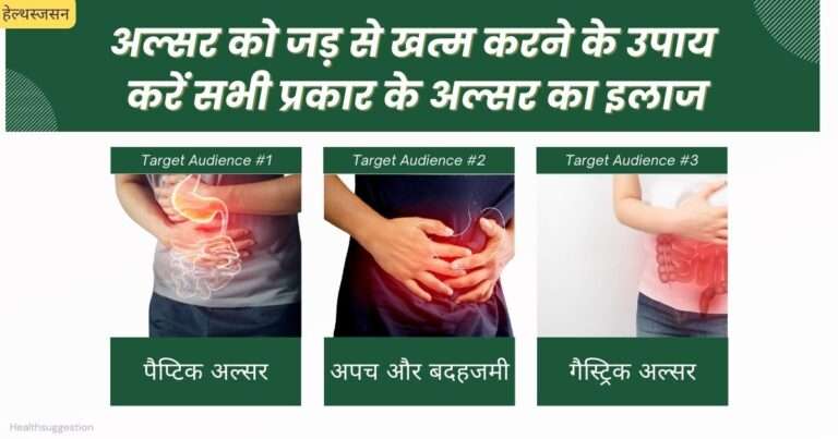 अल्सर को जड़ से खत्म करने के उपाय