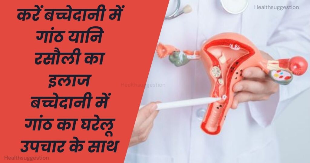 करें बच्चेदानी में गांठ यानि रसौली का इलाज बच्चेदानी में गांठ का घरेलू उपचार के साथ – बच्चेदानी में गांठ होना का रामबाण इलाज – bachedani me ganth ka ghrelu upchar